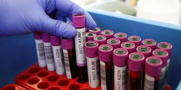 What you need to know about blood donation