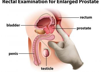 Can Enlarged Prostate Cause Erectile Dysfunction?