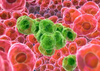 Cancer, Types, Causes, Effects, And Solution