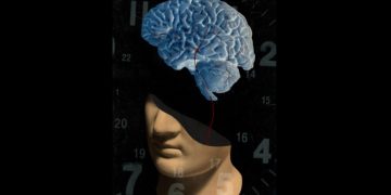 Imaging technique improves outcomes for many stroke patients