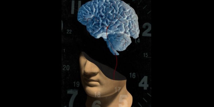 Imaging technique improves outcomes for many stroke patients