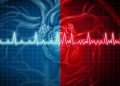 AFib Knowledge