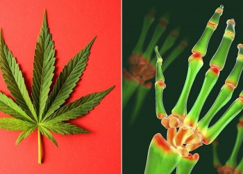 Effectiveness of CBD on rheumatism