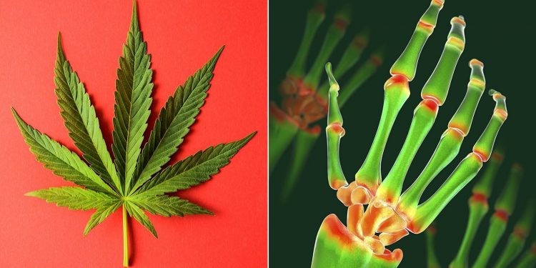 Effectiveness of CBD on rheumatism