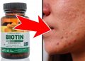 Possible side effects of taking biotin