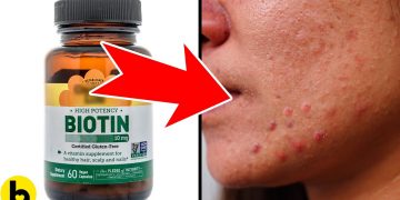 Possible side effects of taking biotin