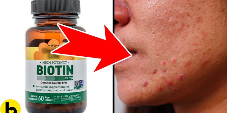 Possible side effects of taking biotin